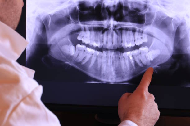 Tooth Infection Emergency Dentist in NE